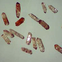 Kristaller av mineralet zirkon (ZrSiO4), ca 0,2 mm långa, sedda i ett vanligt ljusmikroskop. Zirkonerna innehåller små mängder uran, varav en del under tidens lopp sönderfallit till bly. Genom att mäta proportionerna mellan uran och bly i sådana zirkonkristaller kan deras ålder beräknas. Dessa zirkoner kommer från Stockholms-graniten och har en ålder på ca 1800 miljoner år. 
