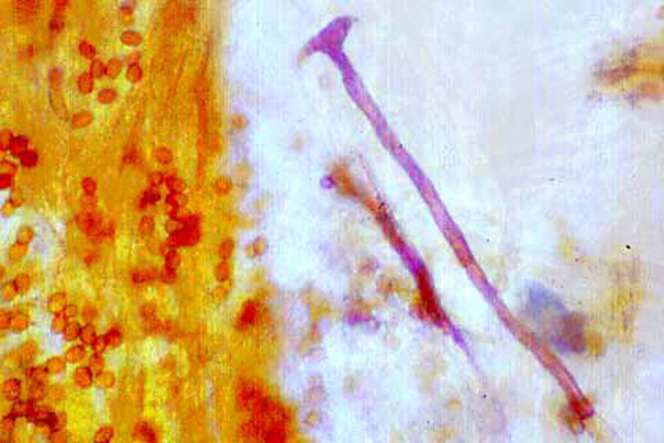 Mikroskopbild av Cystider i den borstiga hatthuden av skillerticka Inonotus cuticularis. Foto: Klas Jaederfeld