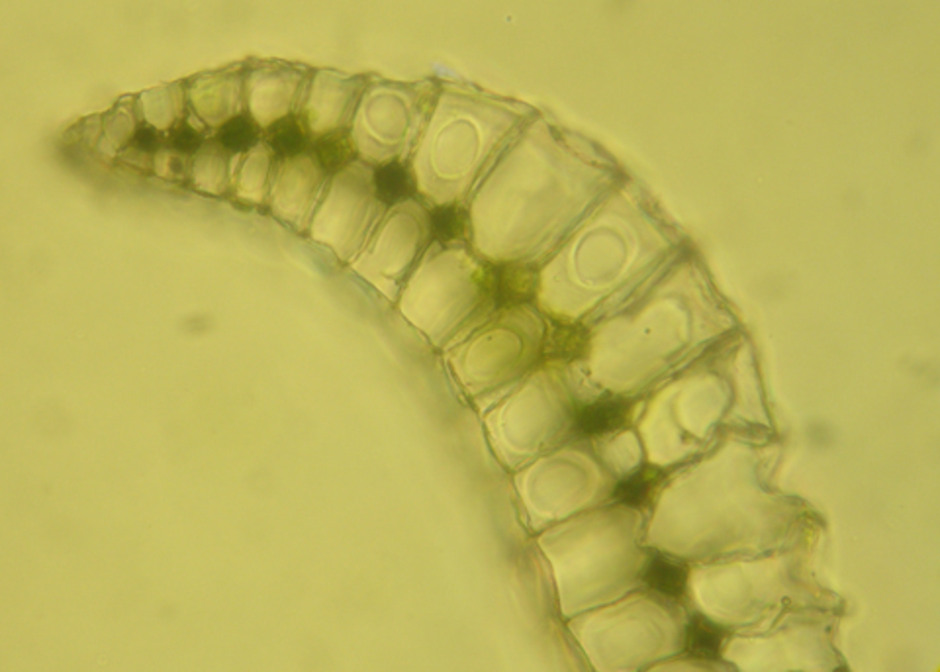 Tvärsnitt av blad. I mitten av bladet syns ett skikt med celler som innehåller grönt klorofyll. På ömse sidor om detta skikt, både på över- och undersidan, finns lager med stora, tomma, vitaktiga celler med tjocka cellväggar. De kan lätt absorbera stora mängder vatten. Foto: Ramona Ubral Hedenberg