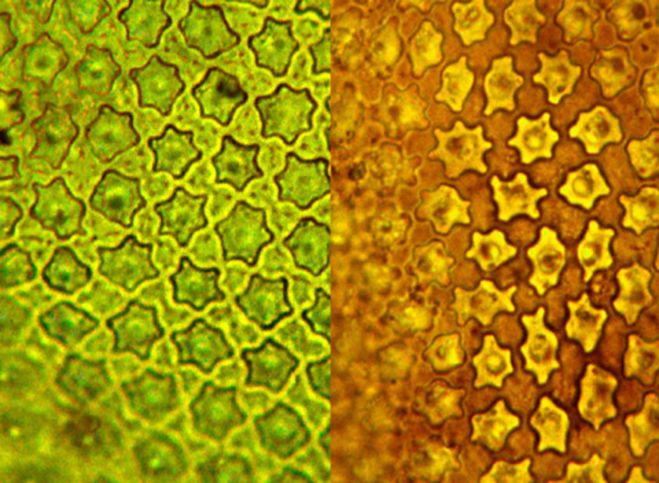 Bladceller hos fjällräffelmossa Aulacomnium turgidum. Recent material till vänster och subfossilt material till höger. Foto: Lars Hedenäs