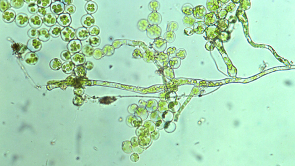 Lysmossans protonema* består av flercelliga trådar och linsformiga celler. Foto: Irene Bisang.