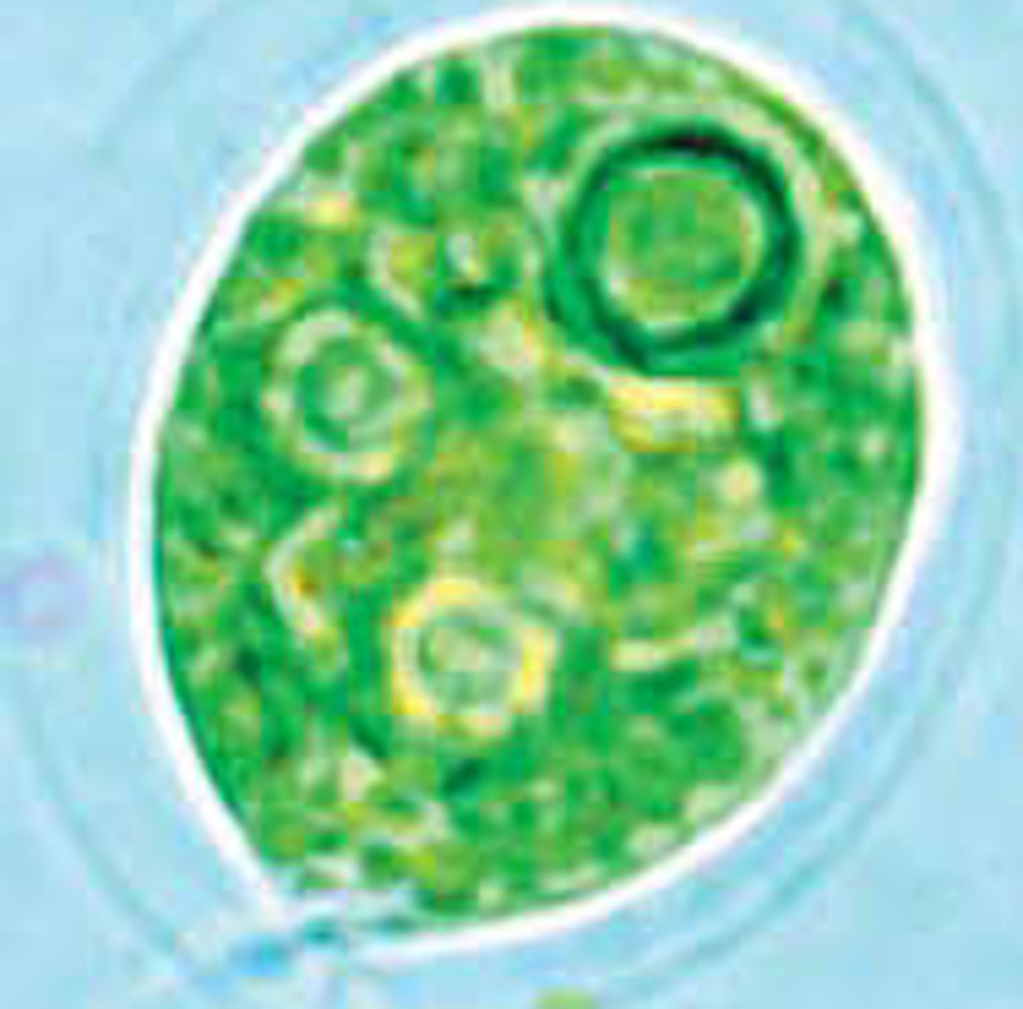 Haematococcus pluvialis är en encellig rörlig grönalg med klorofyll och flageller. Foto: AstaReal