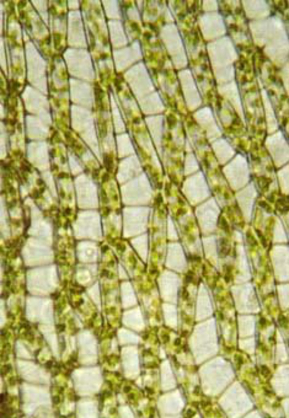 Grenbladsceller hos granvitmossa (Sphagnum girgensohnii). Den vänstra bilden är tagen från bladets konvexsida (d.v.s. utsidan), medan den högra tagits från konkavsidan. Man ser tydligt att de gröna cellerna är bredare på konkavsidan än på konvexsidan, ett kännemärke för den grupp vitmossor där granvitmossan hör hemma. Notera även hyalincellernas tvärgående fibriller och porerna som syns tydligt på konvexsidan. Foto: L. Hedenäs.