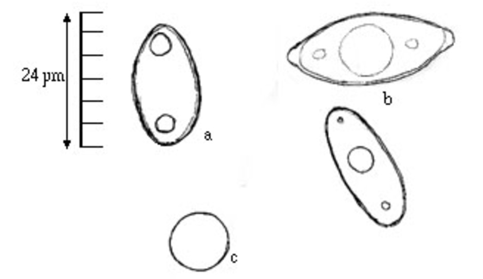 a. Stenmurkla, Gyromitra esculenta har rundat ovala (ellipsoida) sporer med två oljedroppar och måtten 16 -24 x 8 -12 mikrometer. b. Blek stenmurkla, Discina gigas, har tre oljedroppar i sporerna, vanligen en stor i mitten och mindre på var sida. Sporerna är något spetsigare än stenmurklans (ellipsoida till spolformade) och större ( 25 - 35 x 11 -15 mikrometer). c. Klotsporig murkla, Pseudorhizina sphaerospora, har runda sporer med en diameter på 8 - 12 mikrometer. Illustration: Klas Jaederfeldt.